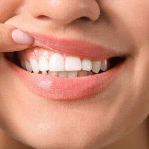Periodontal Disease