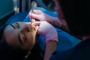 Tooth Extraction