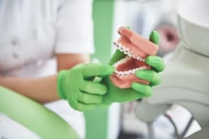 Dental Veneers