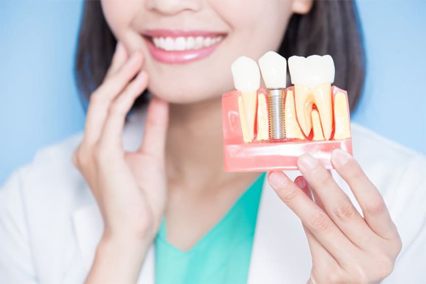 A woman demonstrates a tooth model featuring a dental implant, highlighting its placement and structure.
