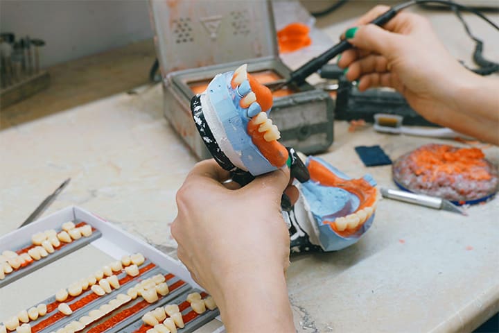 Technicians showing how dentures are made in Northampton