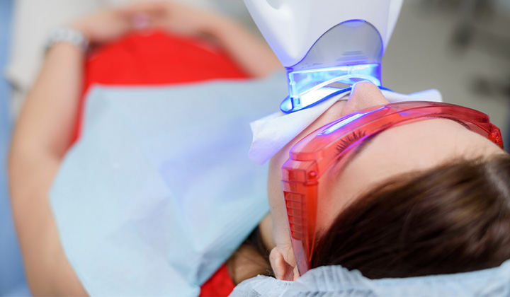 In-office teeth whitening treatment.