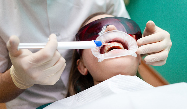 Person receiving in-office teeth whitening.