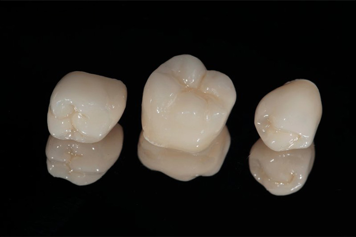 Dental crowns.